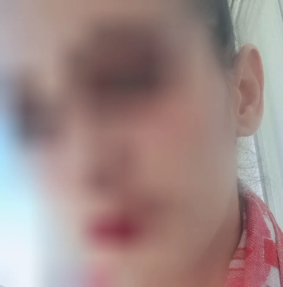 Alice, 37 anni